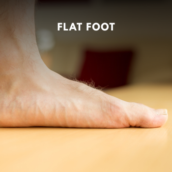 Benefits of Wearing Proper Shoes for Flat Feet