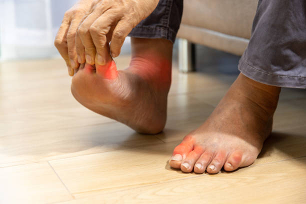 5 Ways to Relieve Arthritis Foot Pain - Diabetic Shoe - An Ortho Shoes Company