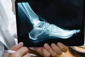 LINK BETWEEN FOOT HEALTH AND OVERALL WELLNESS - Diabetic Shoe - An Ortho Shoes Company