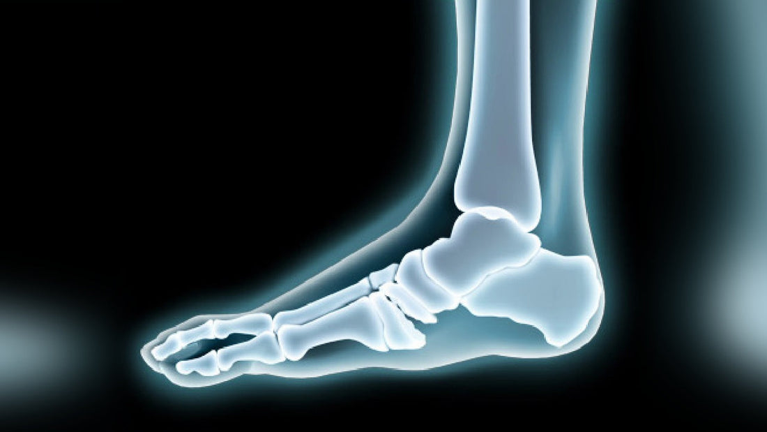 Understanding and Managing Charcot Neuroarthropathy in Diabetes: Diagnosis and Treatment - Diabetic Shoe - An Ortho Shoes Company