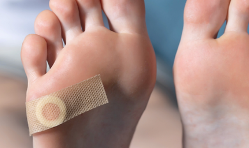 Navigating Foot Warts: When to Seek Specialist Care - Diabetic Shoe - An Ortho Shoes Company