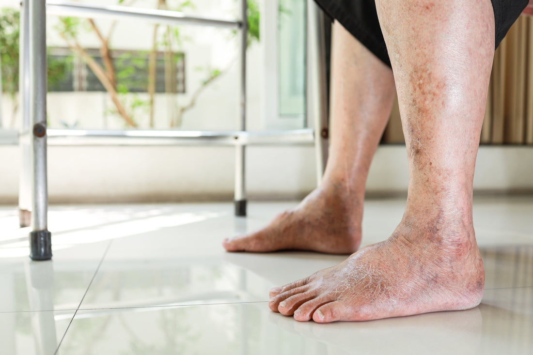The Intricate Connection Between Diabetic Foot Ulcers and Peripheral Artery Disease (PAD) - Diabetic Shoe - An Ortho Shoes Company