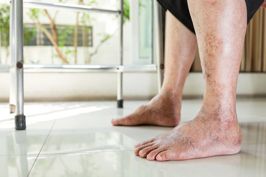 The Intricate Connection Between Diabetic Foot Ulcers and Peripheral Artery Disease (PAD) - Diabetic Shoe - An Ortho Shoes Company