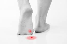 ORTHOPEDIC SHOES FOR PLANTAR WARTS AND CALLUSES - Diabetic Shoe - An Ortho Shoes Company