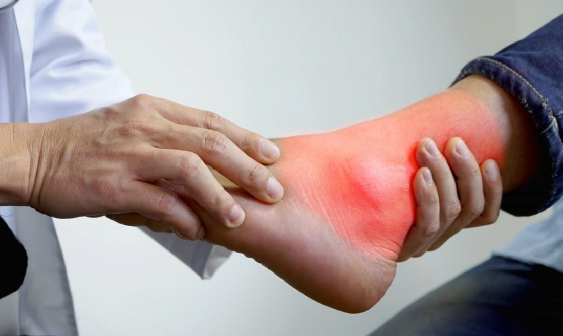 Guarding Against Gout: A Dietary Guide for Wellness - Diabetic Shoe - An Ortho Shoes Company