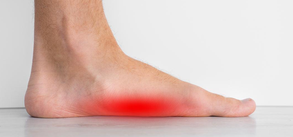 Unlocking Foot Comfort: A Comprehensive Guide to Arch Supports - Diabetic Shoe - An Ortho Shoes Company
