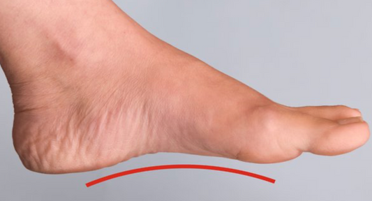 Understanding the Importance of Foot Arches