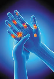 Understanding and Managing Knuckle Joint Pain