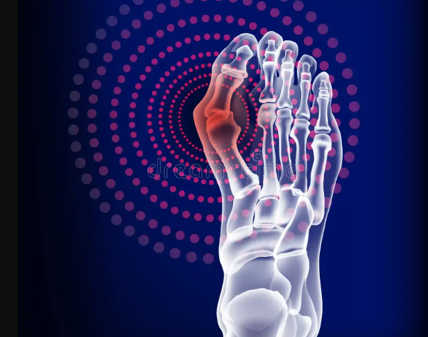Unveiling Foot Pain in Rheumatoid Arthritis: Challenges and Innovations - Diabetic Shoe - An Ortho Shoes Company
