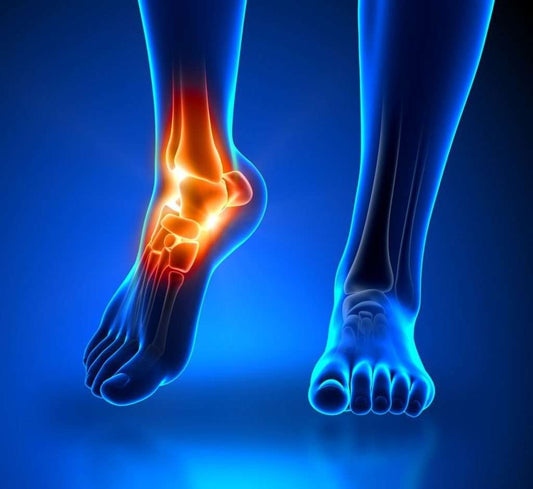 Effective Home Remedies for Ankle Pain Relief