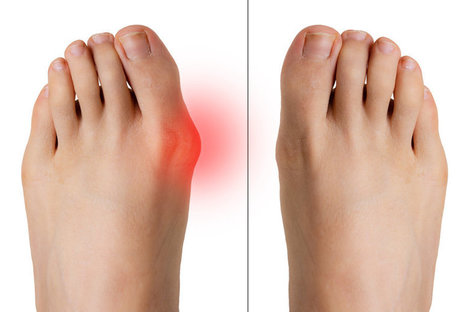 HOW ORTHOPEDIC SHOES WITH WIDE TOE BOXES RELIEVE PRESSURE ON BUNIONS - Diabetic Shoe - An Ortho Shoes Company