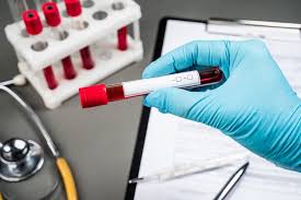 Understanding Blood Tests for Peripheral Neuropathy