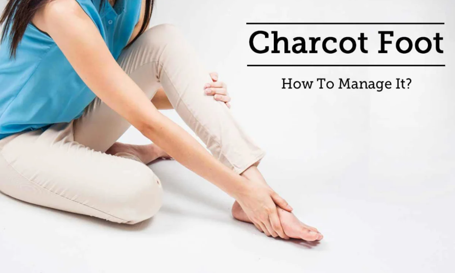 Managing Charcot Arthropathy: Early Detection and Footwear Essentials - Diabetic Shoe - An Ortho Shoes Company
