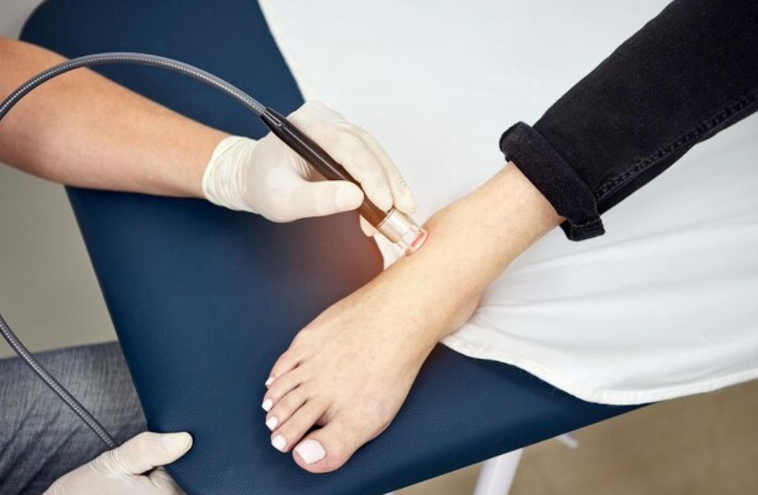 Revolutionizing Pain Relief: Unveiling the Science Behind Cold Laser Therapy for Foot Ailments - Diabetic Shoe - An Ortho Shoes Company
