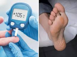 HOW TO SPOT EARLY SIGNS OF FOOT COMPLICATION IN DIABETES