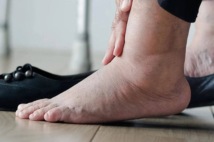 Diabetic Foot Infections: Identification, Risk Factors, and Diagnostic Approach - Diabetic Shoe - An Ortho Shoes Company