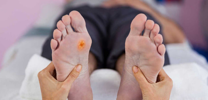 Understanding Foot Ulcers in Diabetic Patients: Causes and Prevention - Diabetic Shoe - An Ortho Shoes Company