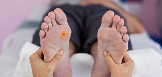 Understanding Foot Ulcers in Diabetic Patients: Causes and Prevention - Diabetic Shoe - An Ortho Shoes Company