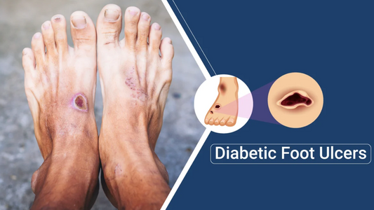 Understanding and Managing Diabetic Foot Ulcers: Factors, Evaluation, and Interventions - Diabetic Shoe - An Ortho Shoes Company
