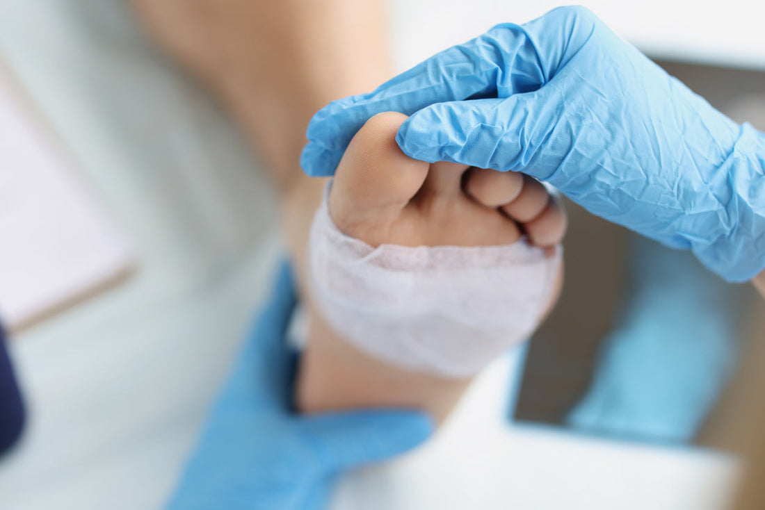 Wound Care for Diabetic Foot Ulcers: Best Practices and Treatment Options - Diabetic Shoe - An Ortho Shoes Company