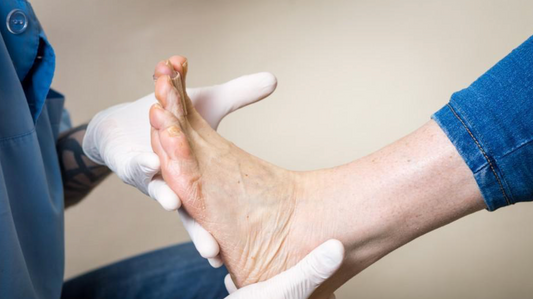 Understanding the Anatomy of the Dorsum of Foot - Diabetic Shoe - An Ortho Shoes Company