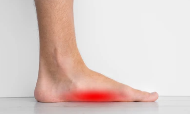 Understanding Flat Foot and Plantar Fasciitis