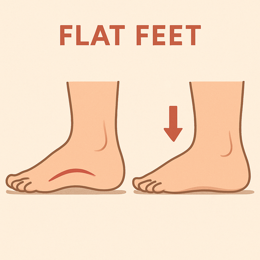 Essential Running Shoes for Flat-Footed Athletes