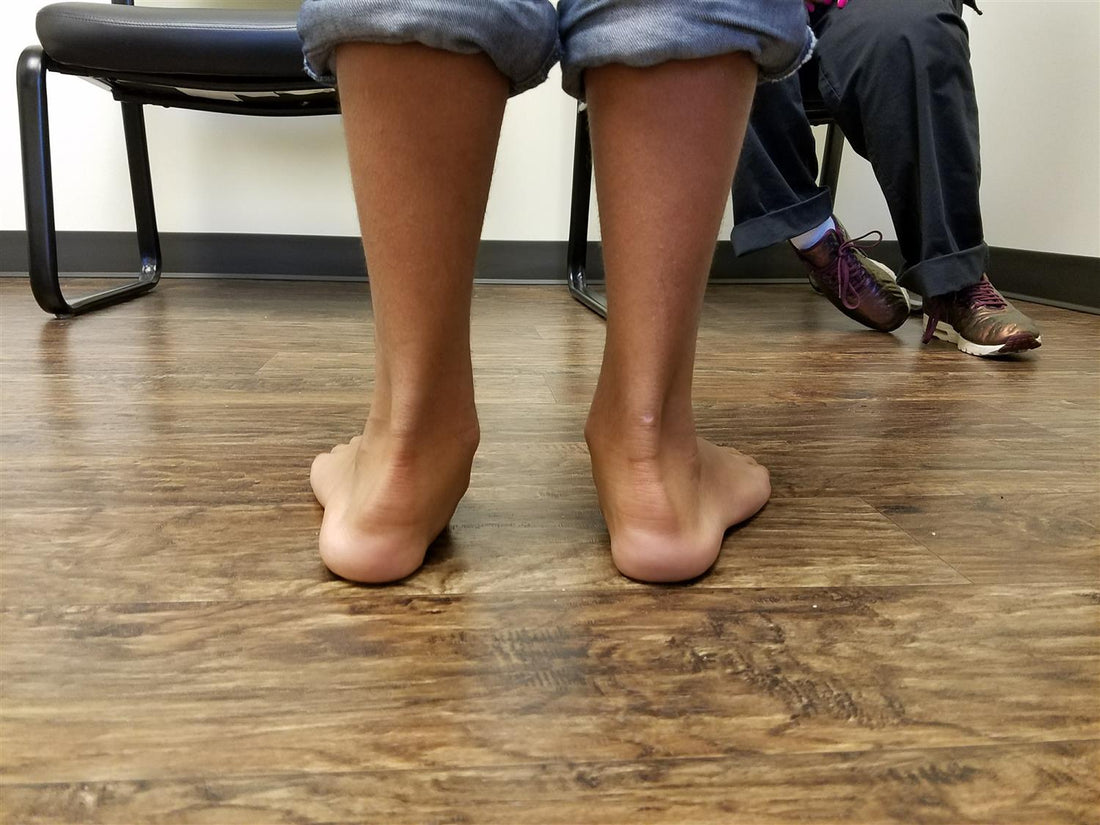 Managing Flexible Flatfoot: Considerations and Strategies - Diabetic Shoe - An Ortho Shoes Company