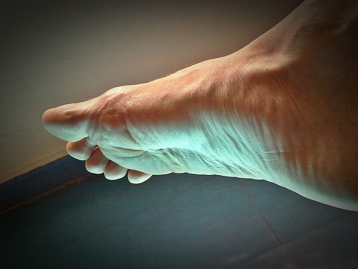 Understanding Your Foot Arches: Identifying and Supporting Your Unique Arch Type - Diabetic Shoe - An Ortho Shoes Company