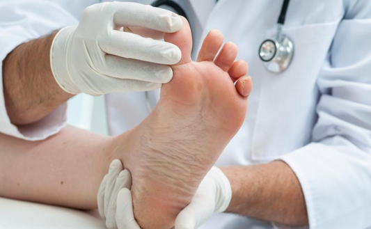 Understanding Planovalgus Foot: Causes and Treatments
