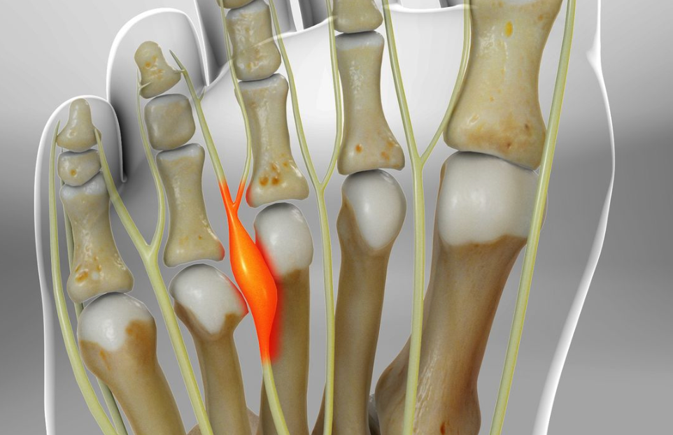 Understanding Different Types of Foot Pain - Diabetic Shoe - An Ortho Shoes Company