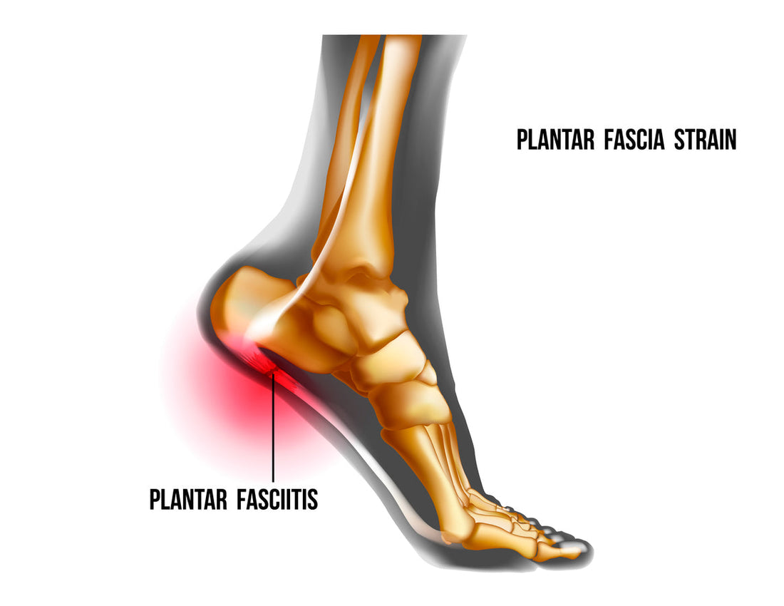 Comprehensive Strategies for Plantar Fasciitis Relief - Diabetic Shoe - An Ortho Shoes Company