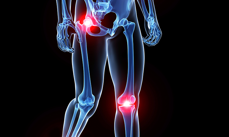 Optimizing Joint Health: The Crucial Role of Exercise for Knee and Hip Problems - Diabetic Shoe - An Ortho Shoes Company