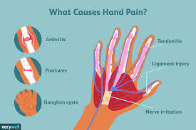 Causes and Solutions for Hand Numbness