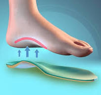 Benefits of Medial Arch Support Footwear