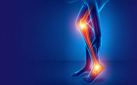 Understanding Nerve Compression Syndrome Symptoms and Treatments