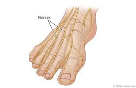 Understanding Axonal vs. Demyelinating Neuropathy
