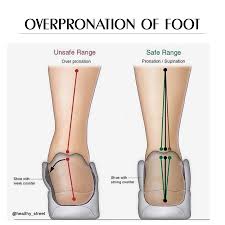 Features to Look for in Shoes for Overpronation