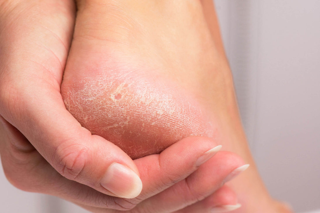 Is Heel Pain a Sign of Cancer? What You Really Need to Know