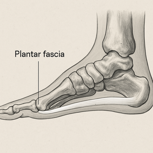 Can Shoes Cause Plantar Fasciitis? What You Need to Know