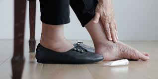 REAL-LIFE STORY - HOW DIABETIC SHOES IMPROVED FOOT HEALTH