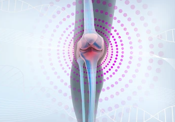 Navigating Life with Rheumatoid Arthritis: The Impact of Specialized Footwear on Mobility - Diabetic Shoe - An Ortho Shoes Company