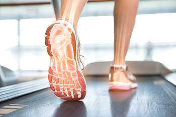 Understanding Metatarsal Pain: Causes and Treatments - Diabetic Shoe - An Ortho Shoes Company