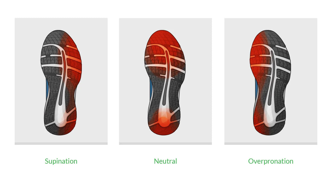 Understanding Supination, Overpronation, and the Right Footwear for Your Comfort