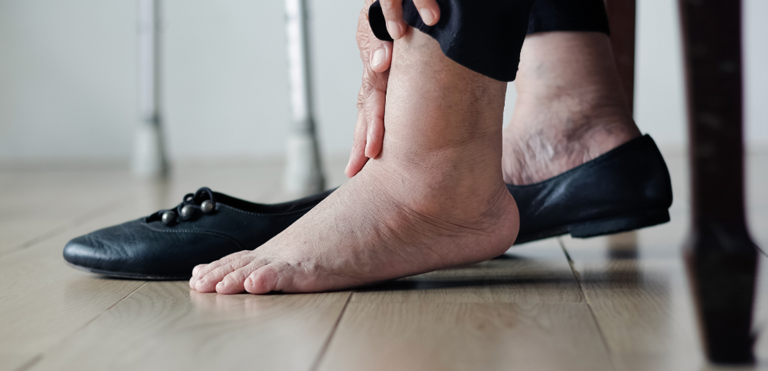 Causes and Remedies for Winter Foot Swelling - Diabetic Shoe - An Ortho Shoes Company