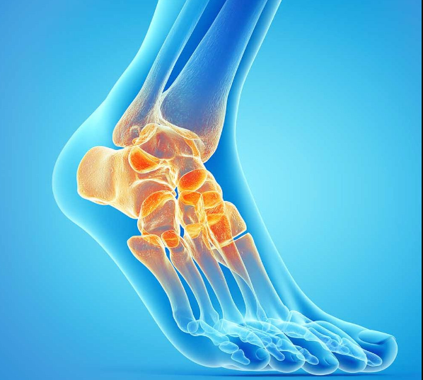 Decoding Varus Ankle Osteoarthritis: A Comprehensive Exploration - Diabetic Shoe - An Ortho Shoes Company